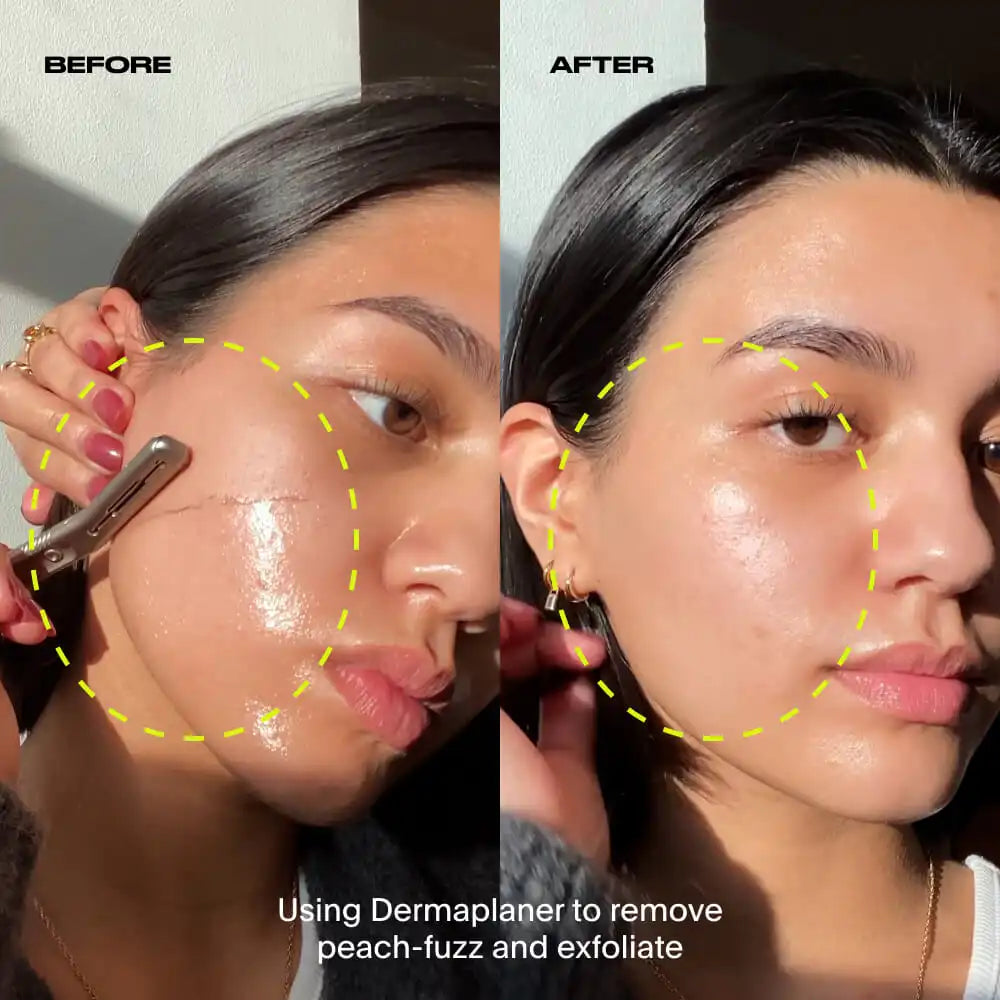 Dermaplaner Kit, Fig